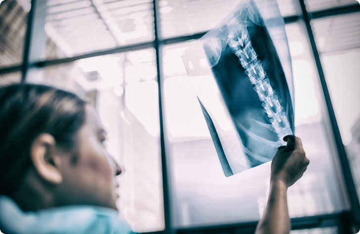 Lekarka ogląda pod światło zdjęcie RTG kręgosłupa